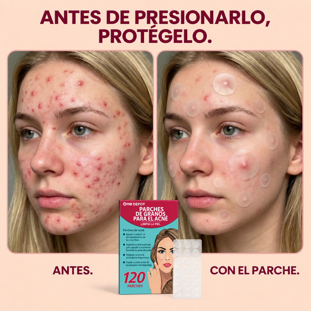 Parches para Granitos | Evita Tocarlos y Protege tu Piel